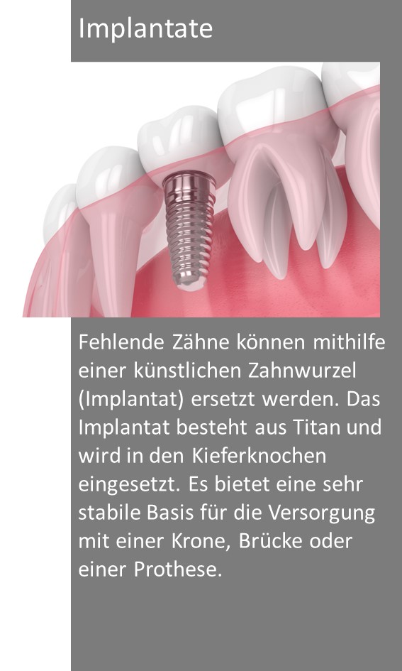 Zahnarzt Eschwege Implantate